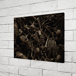 Холст прямоугольный Человеческие кости, цвет: 3D-принт — фото 2