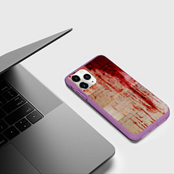 Чехол iPhone 11 Pro матовый Бинты 1, цвет: 3D-фиолетовый — фото 2