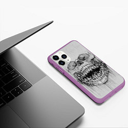 Чехол iPhone 11 Pro матовый Dentist skull, цвет: 3D-фиолетовый — фото 2