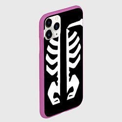 Чехол iPhone 11 Pro матовый Инцидент Кэмоно, цвет: 3D-фиолетовый — фото 2