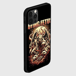 Чехол для iPhone 12 Pro Max Dying Fetus, цвет: 3D-черный — фото 2
