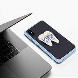 Чехол iPhone XS Max матовый Amazing Dentist, цвет: 3D-голубой — фото 2